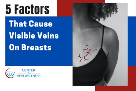 "This is because the blood volume increases by approximately. . Boobs with veins pics